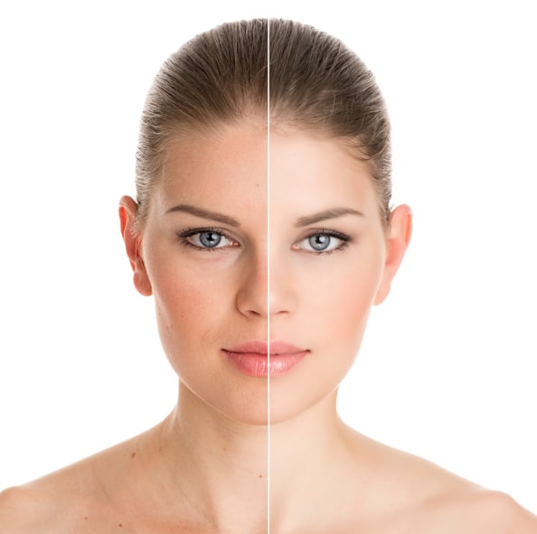 Three Dimensions of Skin Rejuvenation