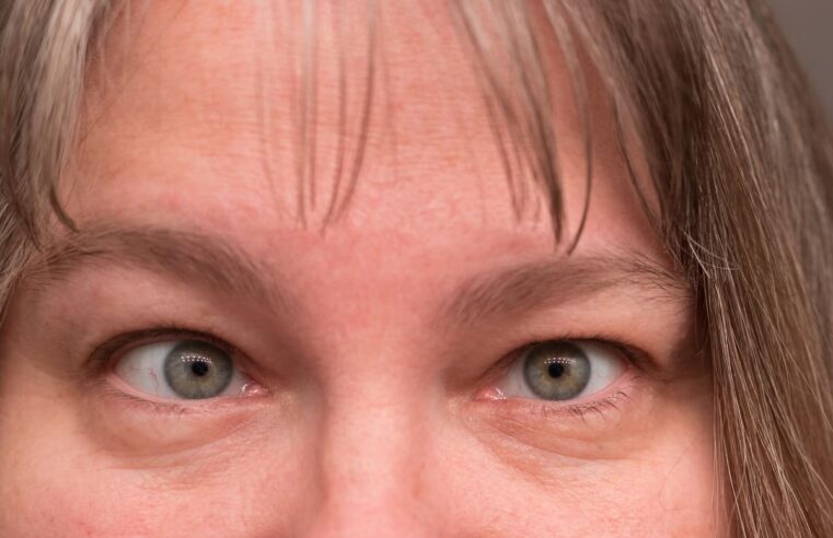 Learn The Causes And Solutions To Lazy Eye Disease